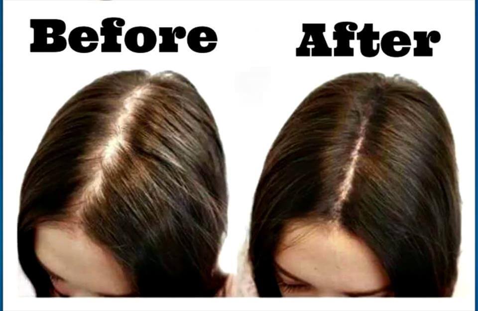 Natural Remedies For Beautiful Hair Natural Remedies For Beautiful Hair